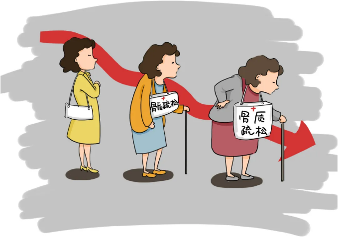 骨密度测试报告的SOS值是多少?超声波骨密度检测仪教你清楚地报告你的骨密度 骨密度测试报告的SOS值是多少?超声波骨密度检测仪教你清楚地报告你的骨密度