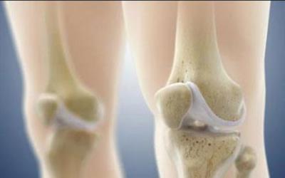 国康骨密度仪品牌资讯-钙和磷吸收越多对身体越好吗?