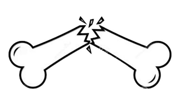 (广东佛山)骨密度检测仪厂家科普-骨裂的症状有哪些?