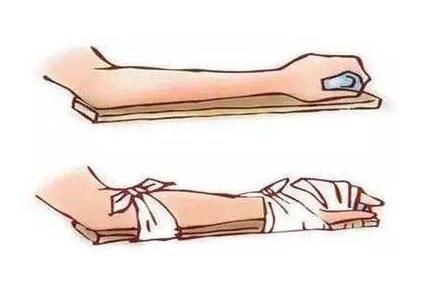 626国康超声波骨密度检测仪小课堂;你知道骨折需要多久才能愈合吗?