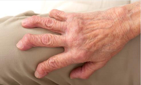 630便携式骨密度检测仪介绍:骨硬化症有什么症状?主要原因是什么?