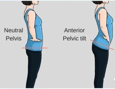 gk超声骨密度检测仪厂家-教你骨盆前倾自我矫正的5个技巧!